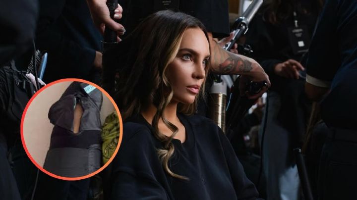 Belinda revela que enfrentará operación tras dolorosa lesión; esto dijo | VIDEO