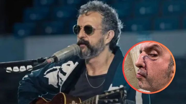 Tito Fuentes rompe el silencio y muestra las secuelas de las drogas en su rostro