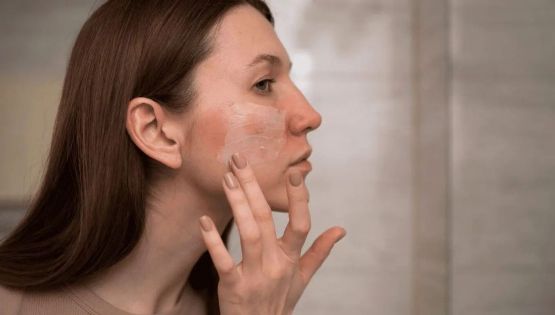 Cómo prevenir las manchas en la cara; hábitos diarios que protegen tu piel