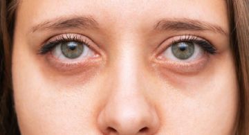 Por qué salen las ojeras y cómo evitarlas: causas reales y soluciones efectivas