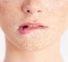 Qué vitamina falta cuando se te parten los labios; señales que el cuerpo envía y no hay que ignorar