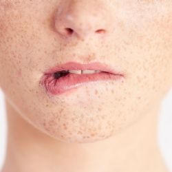 Qué vitamina falta cuando se te parten los labios; señales que el cuerpo envía y no hay que ignorar