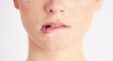 Qué vitamina falta cuando se te parten los labios; señales que el cuerpo envía y no hay que ignorar