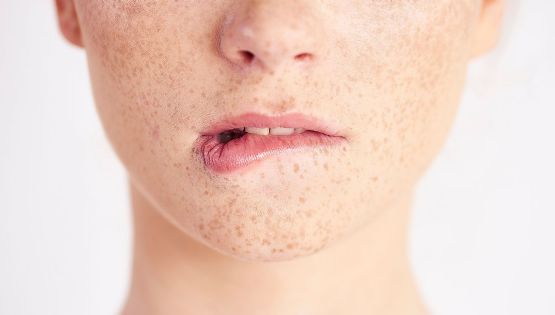 Qué vitamina falta cuando se te parten los labios; señales que el cuerpo envía y no hay que ignorar