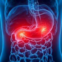 Dile adiós al ardor estomacal con estos remedios caseros fáciles y efectivos