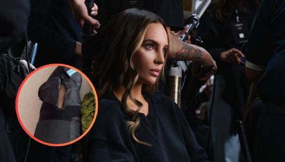 Belinda revela que enfrentará operación tras dolorosa lesión; esto dijo | VIDEO