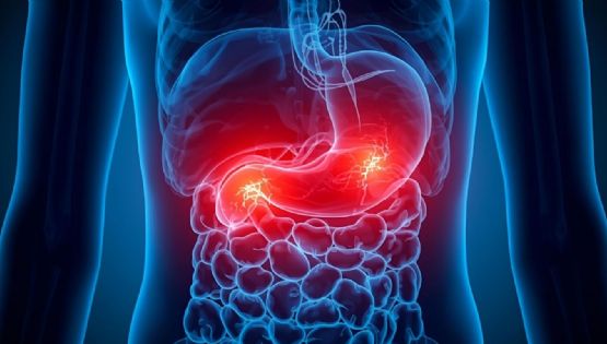 Dile adiós al ardor estomacal con estos remedios caseros fáciles y efectivos