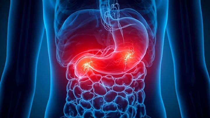 Dile adiós al ardor estomacal con estos remedios caseros fáciles y efectivos