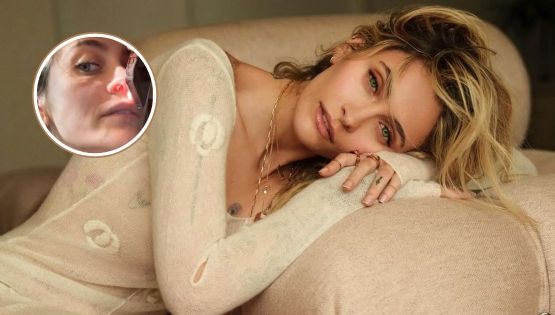 Paris Jackson y la sorprendente confesión sobre sus adicciones; la cantante muestra las secuelas