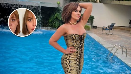 Gaby Spanic causa revuelo con su rejuvenecimiento extremo; estos son los procedimientos que se hizo