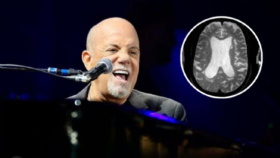 Billy Joel es diagnosticado con trastorno neurológico; cancela gira mundial