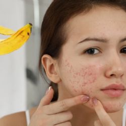 ¿Manchas y acné? Así puedes usar la cáscara de plátano para mejorar tu piel