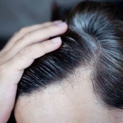 ¿Tu cabello se volvió blanco de pronto? El estrés podría ser la causa
