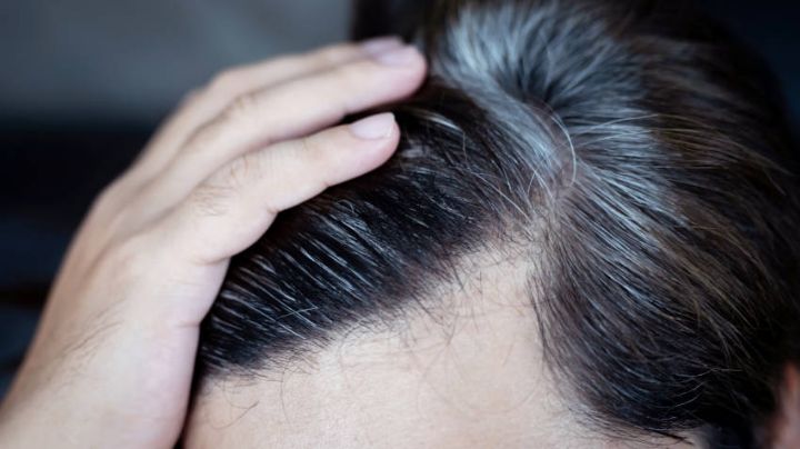 ¿Tu cabello se volvió blanco de pronto? El estrés podría ser la causa
