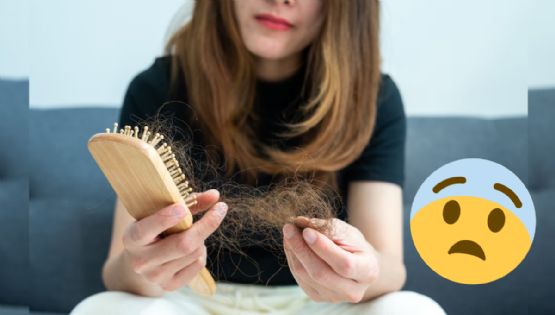 ¿Se te está cayendo el cabello?, descubre si se trata de estrés o genética