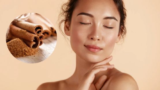 ¿Sirve la canela para el acné? Esto dicen expertos sobre usarla en el rostro