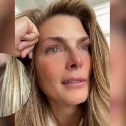 ¿Qué le pasó en el ojo a Montserrat Oliver?, ella revela lo que ocurrió