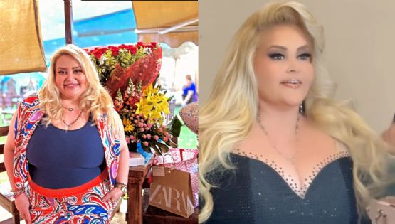 Sheyla transforma su cambio físico en esperanza; dona 8 kilos de piel a niños con quemaduras