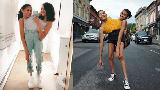 Gemelas siamesas mexicanas se casan; esta fue su historia de amor | VIDEO