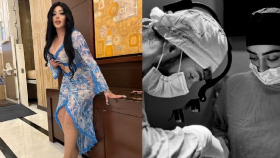 Bellakath tomará medidas legales contra cirujano que la tomó como ‘mal ejemplo’ de cirugía estética