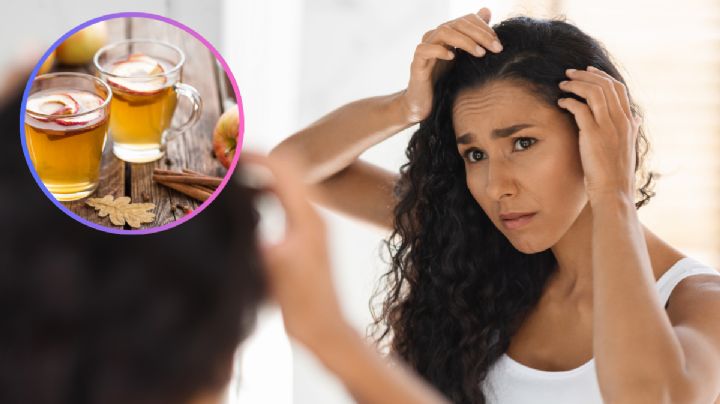 Cómo eliminar la caspa rápido: el remedio casero más popular que funciona mejor que muchos shampoos