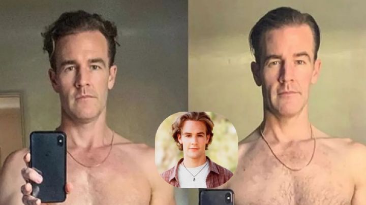 James Van Der Beek: su lucha contra el cáncer y el llamado global a la detección temprana