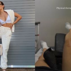Así luce Michelle Salas después del terrible accidente que le dejó una grave lesión