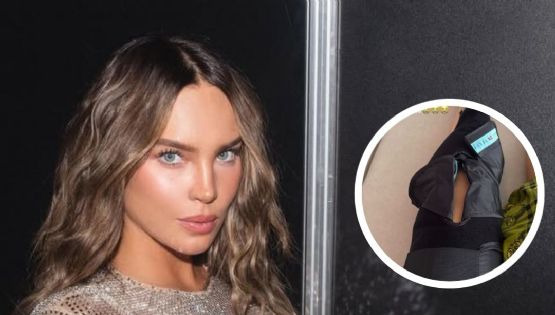 Belinda sufre terrible lesión; ¿qué ocurrirá con sus proyectos?