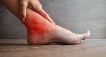 Remedios caseros para reducir el ácido úrico; tratamientos naturales que realmente funcionan